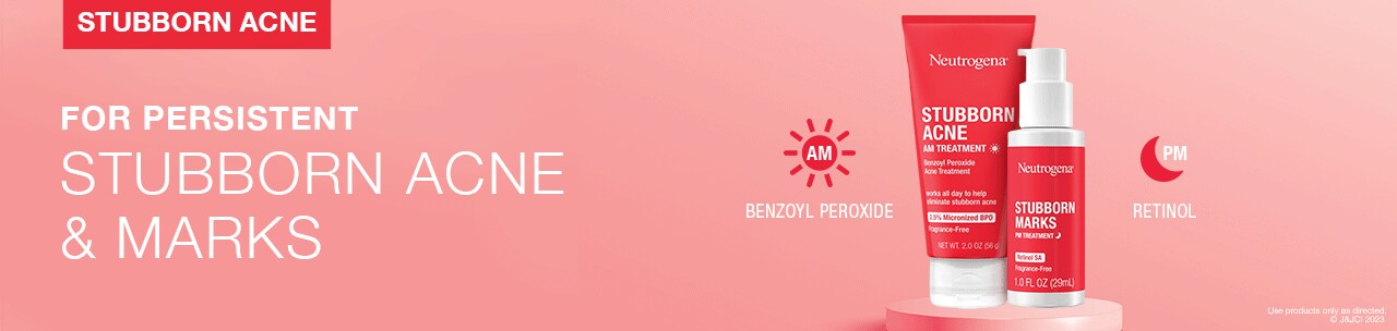 for persistent stubborn acne and marks